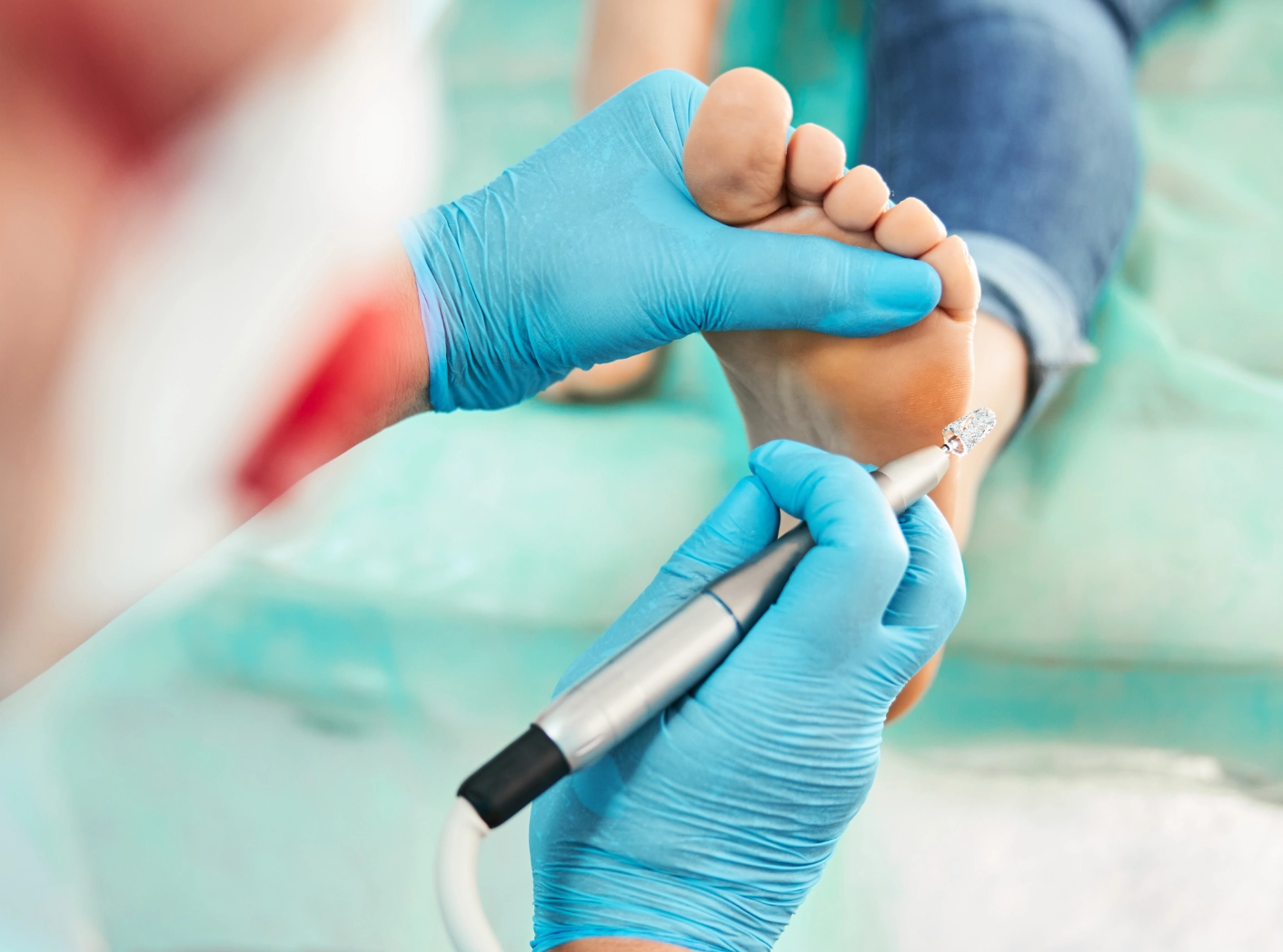 Pédicure Médicale