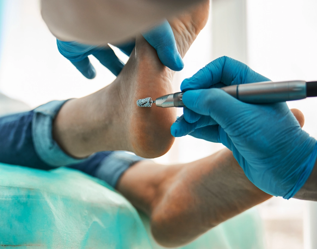 Patient recevant un soin de pédicure médicale